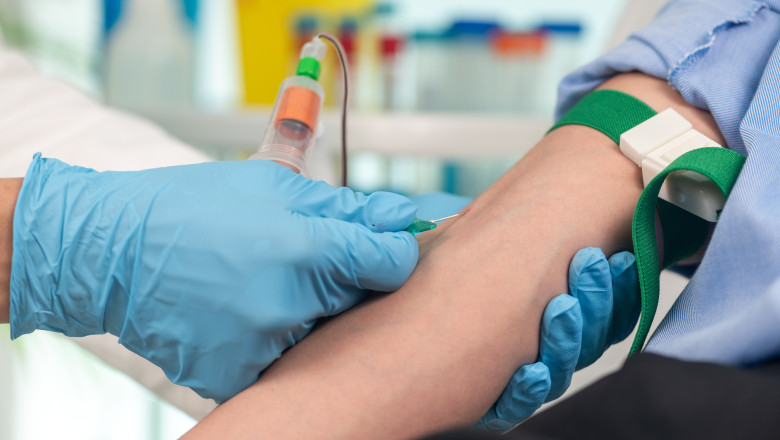 Analize gratuite la Baia de Fier